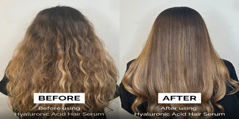 hyaluronic acid for hair