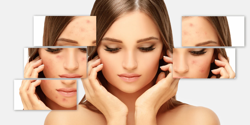 zinc for skin