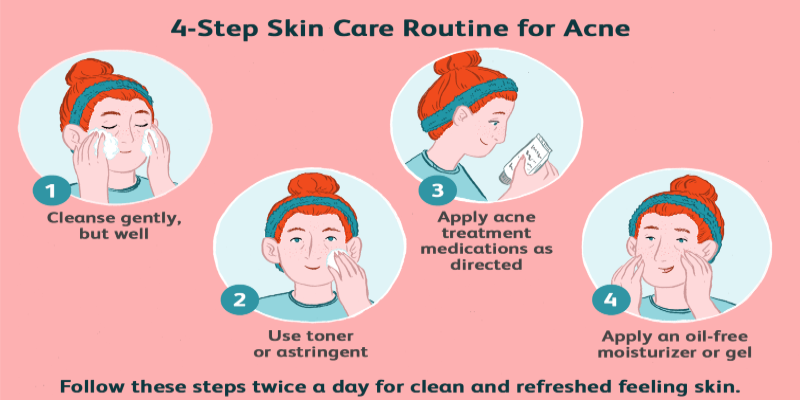 Acne prone skin care routine