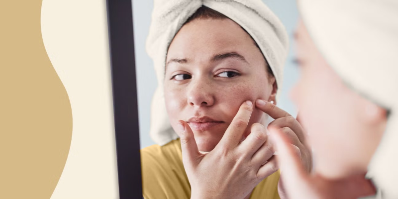 acne treatments