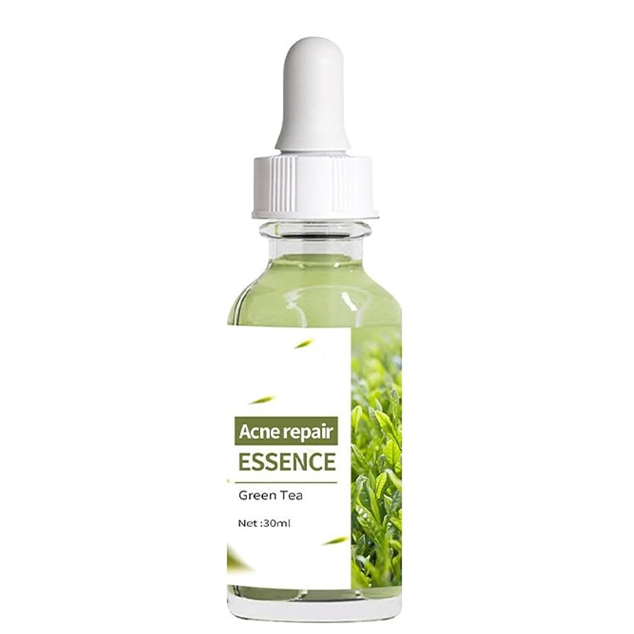 green tea serum for redness